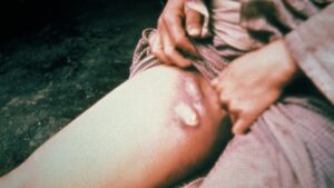 China Declares Level-3 Alert As Bubonic Plague Spreads In Northern Province, Seals Village