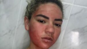 Instagram Model Mari Valents Uses Her ‘Period Blood’ as Face Pack to Stay Young