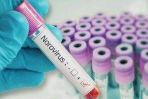 US: Norovirus On The Rise, What You Need To Know About Its Spread, Symptoms, And Precautions