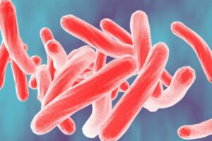 Buruli Ulcer: Flesh-Eating Bacteria Spreads Rapidly Across Australia